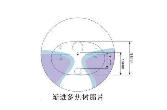 美麗島多焦鏡適合的人群，需要注意的事項